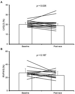 Exercise-Induced Cardiac Fatigue in Recreational Ultramarathon Runners at Moderate Altitude: Insights From Myocardial Deformation Analysis